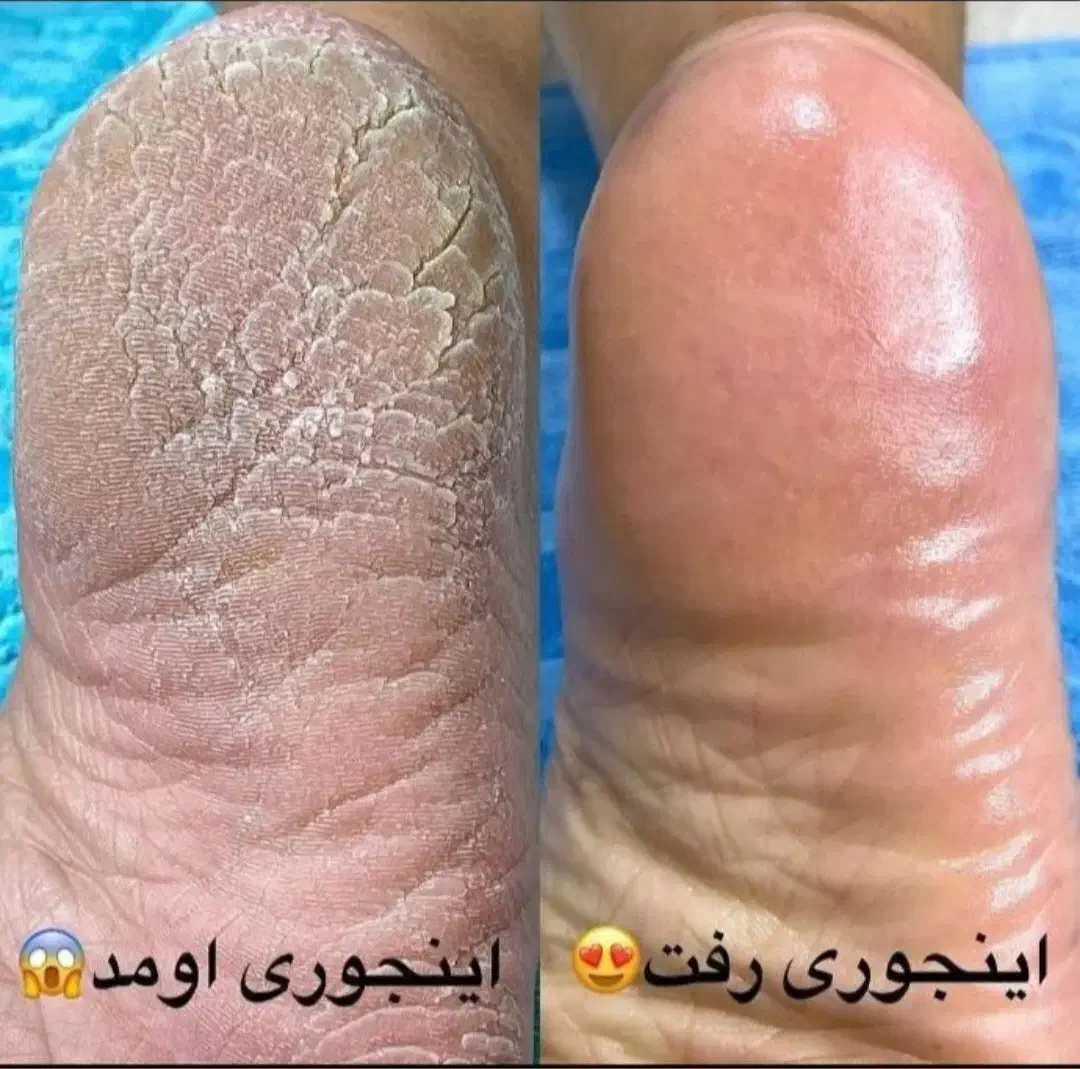 انجام خدمات کاشت ناخن وپدیکور|خدمات آرایشگری و زیبایی|پاسارگاد, |دیوار