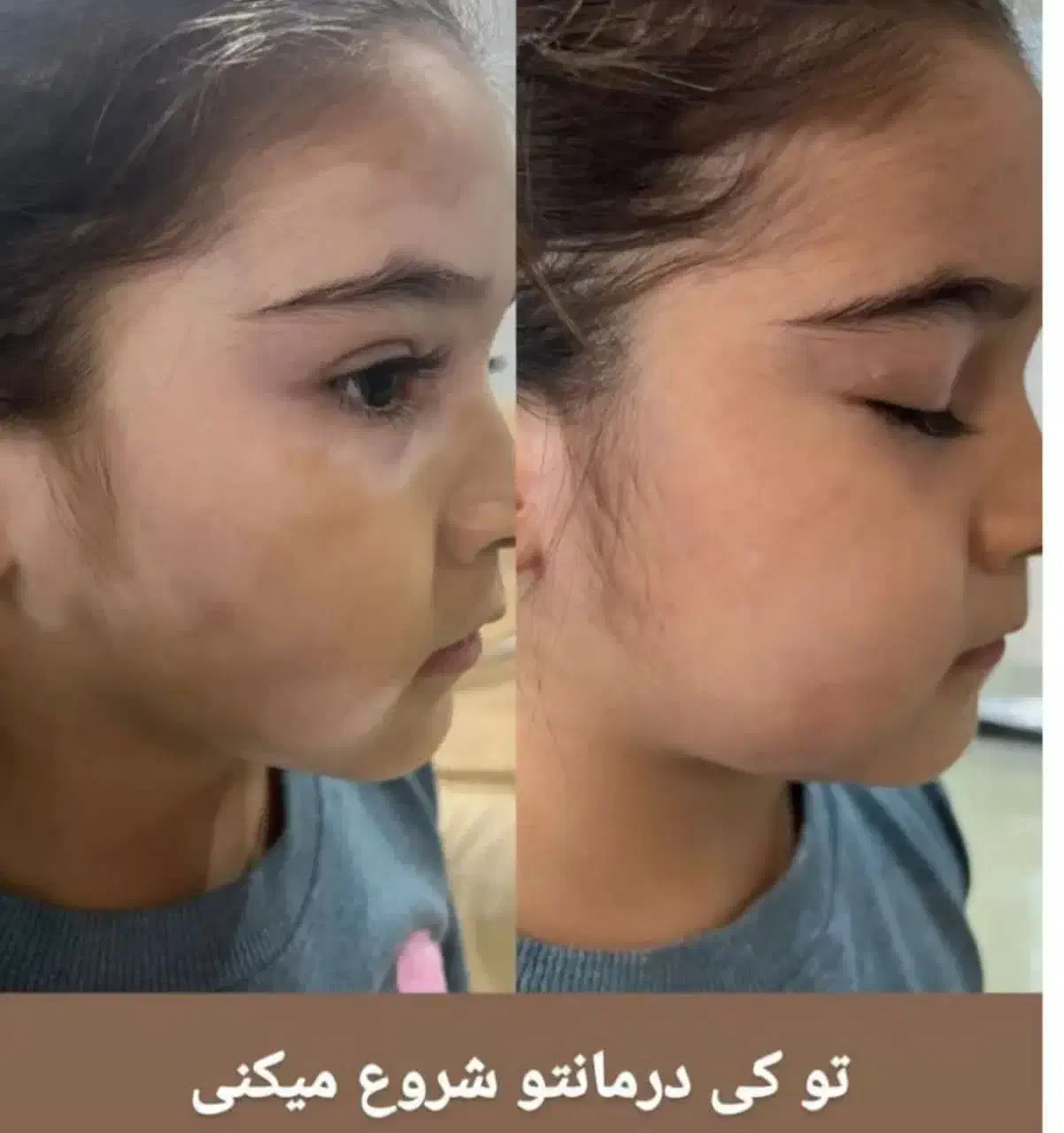 روغن های کاژان|آرایشی، بهداشتی، درمانی|بهبهان, |دیوار