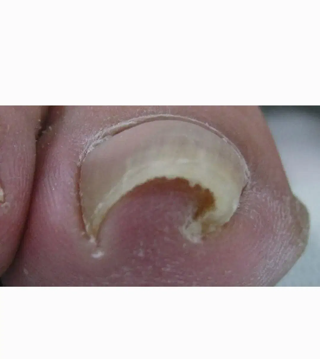 اصلاح ناخن کج/حجامت/فصد خون/میخچه|خدمات آرایشگری و زیبایی|تبریز, |دیوار