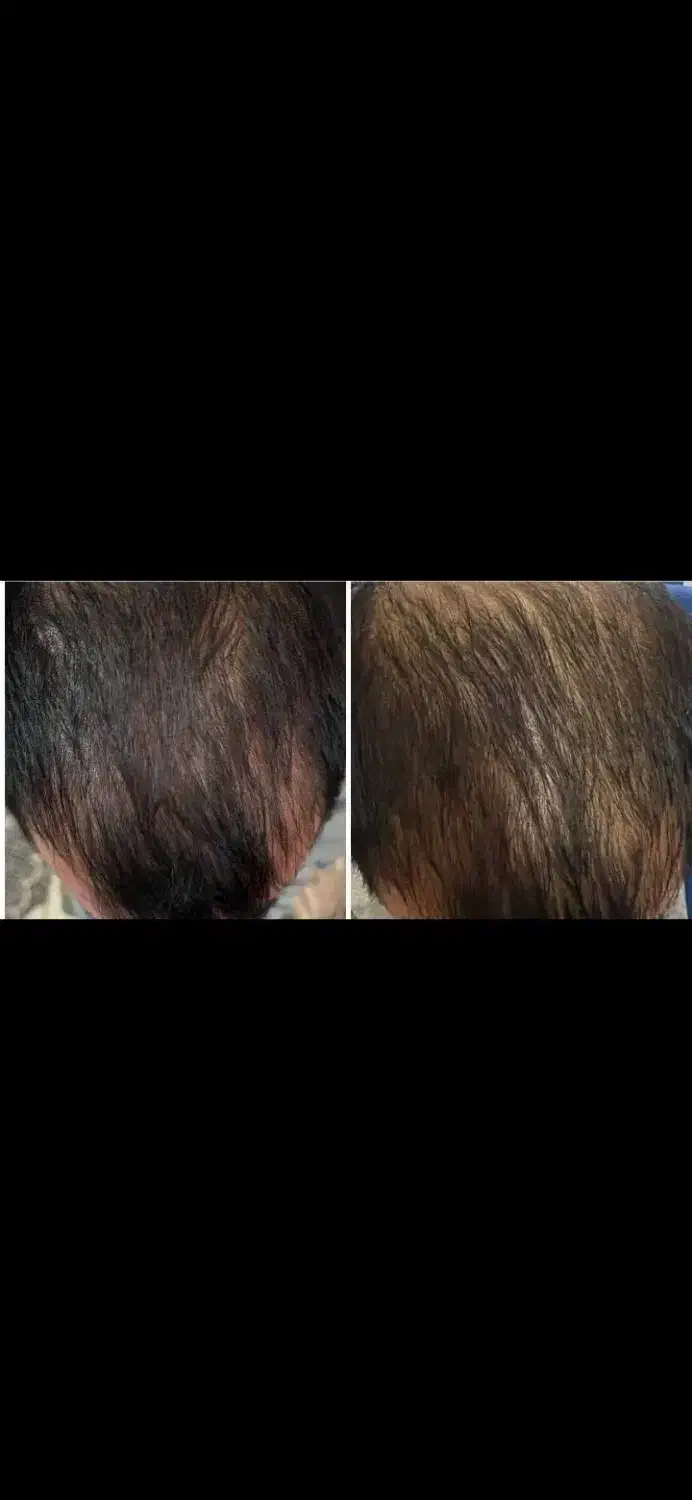 روغن فندق اصل|آرایشی، بهداشتی، درمانی|رشت, باهنر|دیوار