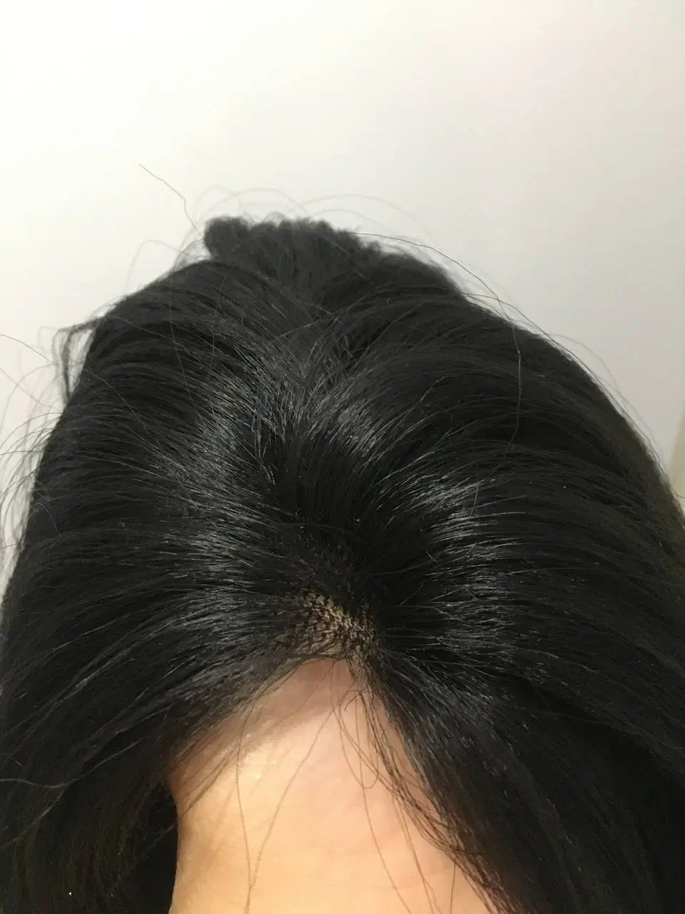 پوستیژ توردار|آرایشی، بهداشتی، درمانی|قرچک, داوود آباد|دیوار