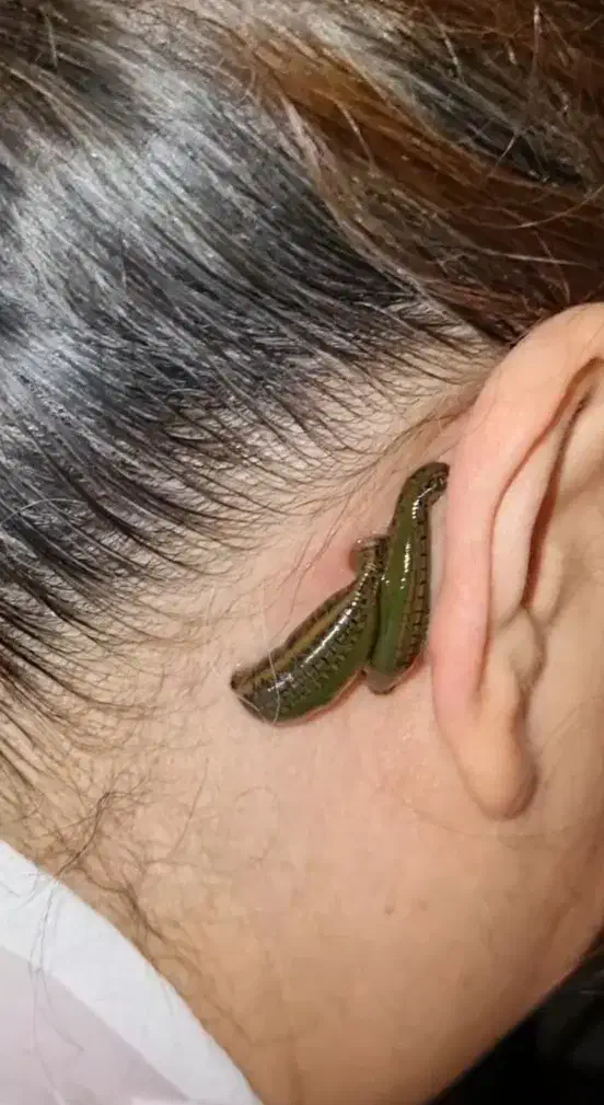 حجامت ،فصدوزالو،سم زدا ویونیزاسیون ماساژ درمانی|خدمات آرایشگری و زیبایی|سنندج, |دیوار