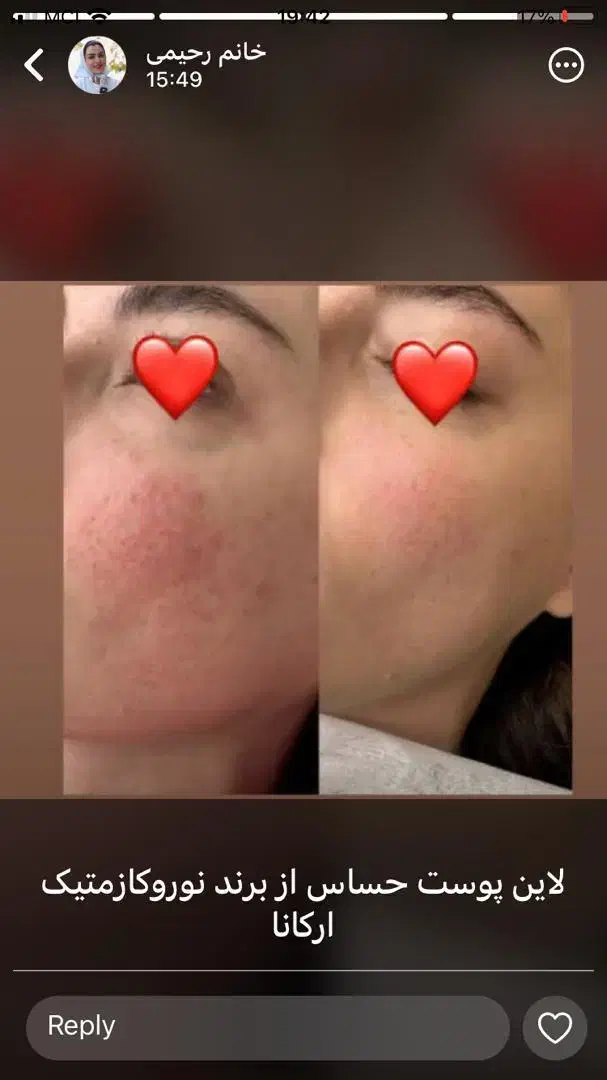 پاکسازی وفشیال تخصص آقا و خانم|خدمات آرایشگری و زیبایی|قم, بلوار امین و ساحلی|دیوار