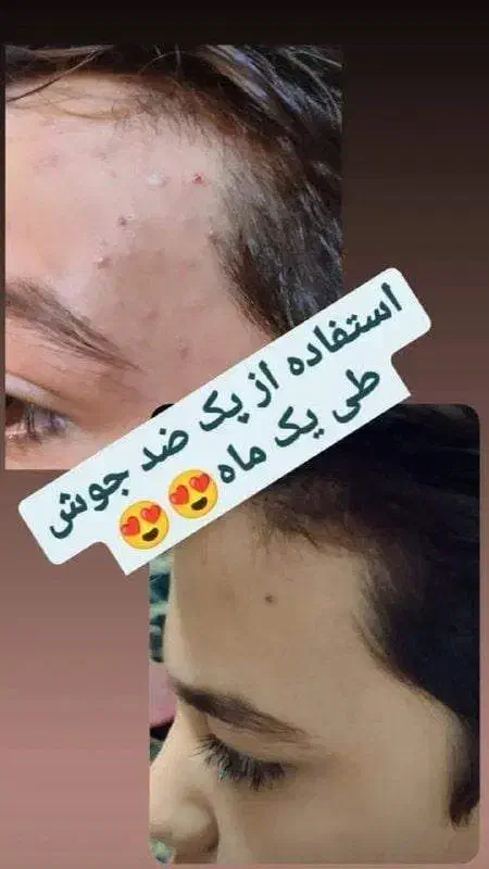 دعوت به مشاوره رایگان|آرایشی، بهداشتی، درمانی|شیراز, ابیوردی|دیوار