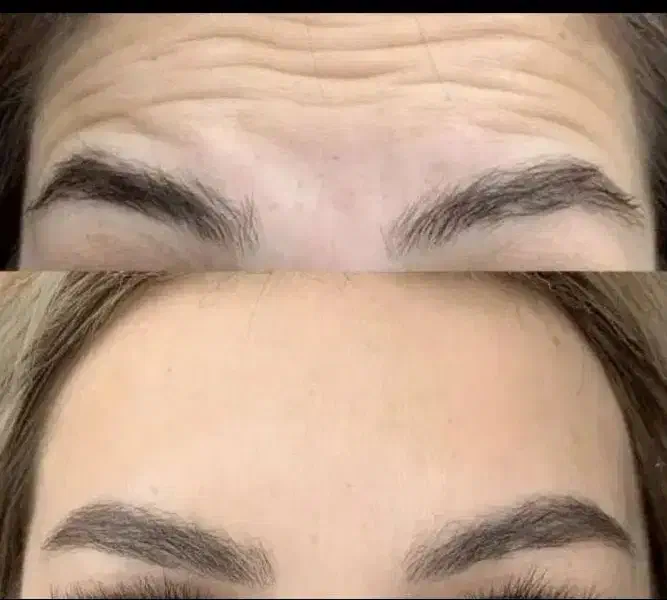 ژل .بوتاکس.انزیم،انواع پرسینگ با بهترین کیفیت.|خدمات آرایشگری و زیبایی|ملایر, |دیوار