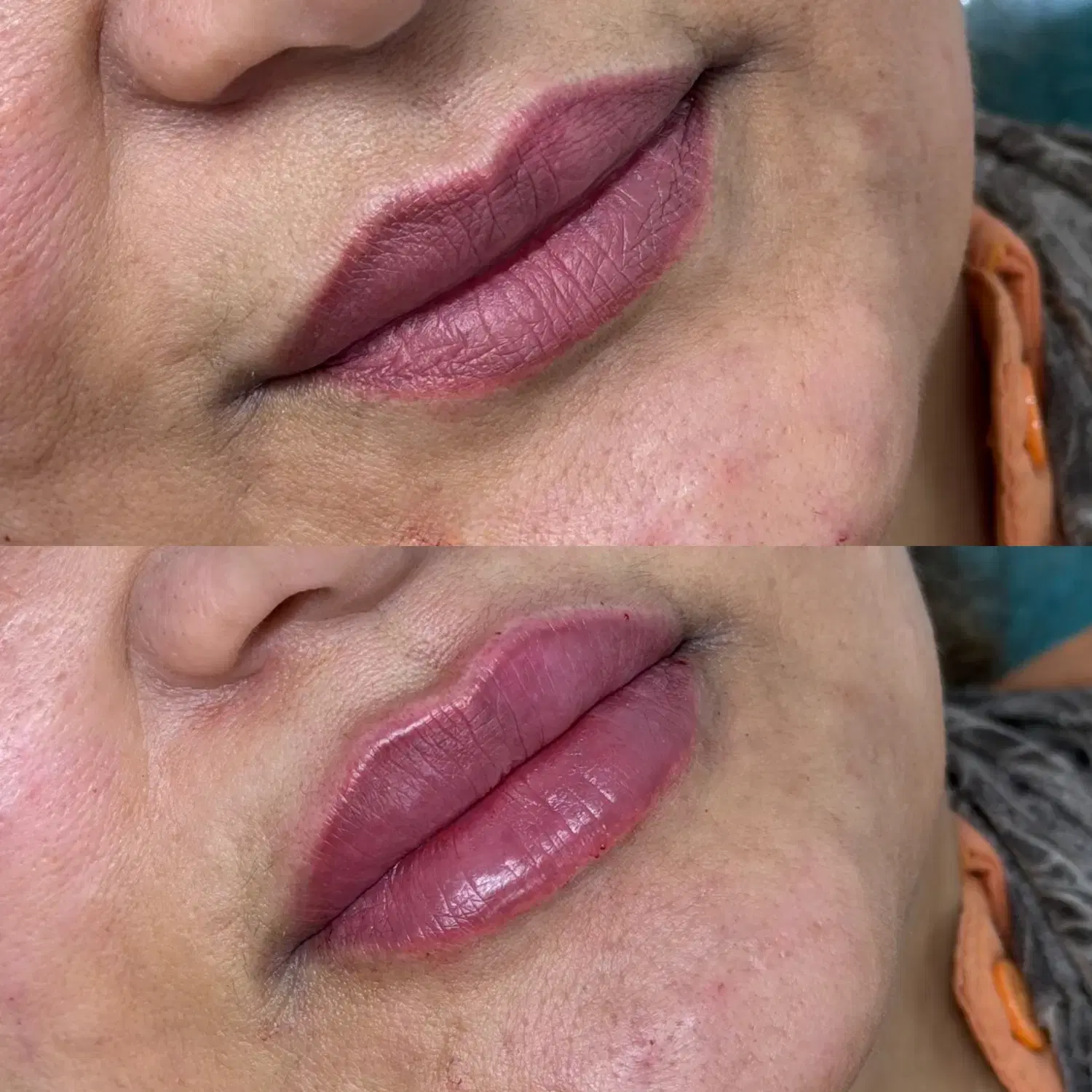 کلینیک دکتر امیررضا مهدویان/ژل بوتاکس لیزر|خدمات زیبایی و سلامت|اهواز, گلستان|دیوار