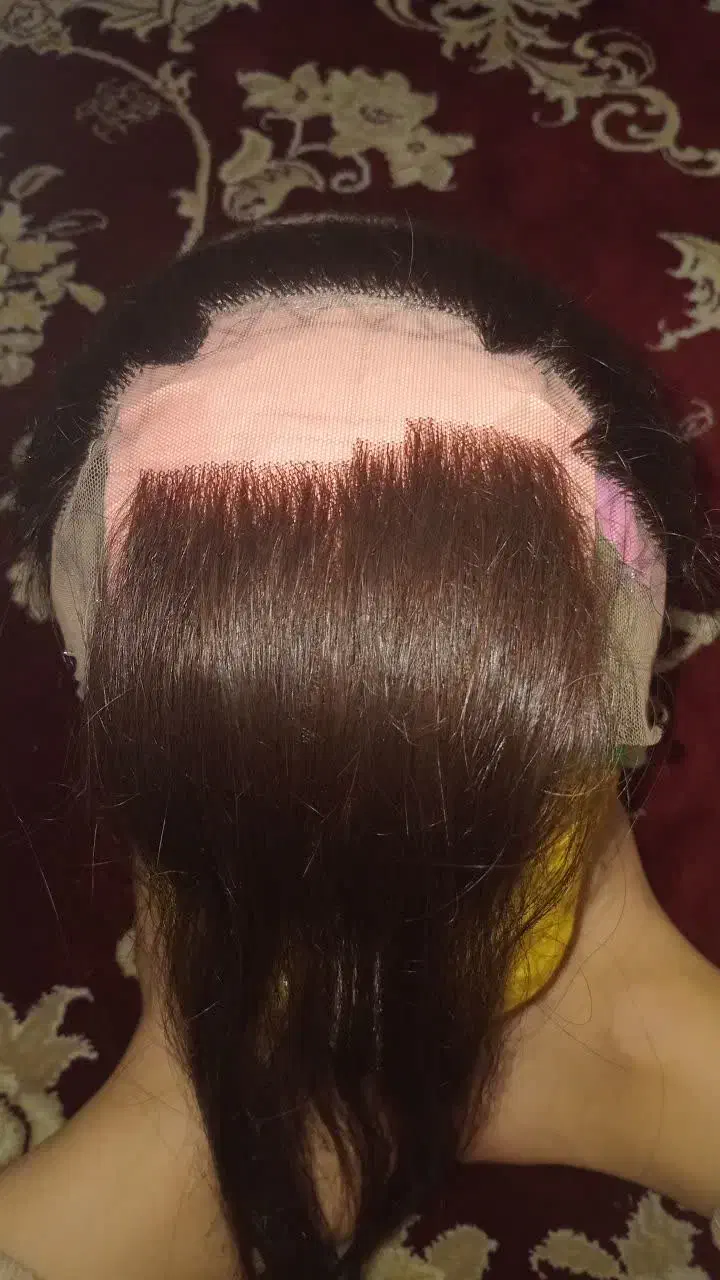 پروتز مو زنانه مردانه|آرایشی، بهداشتی، درمانی|تهران, شهرک ولیعصر جنوبی|دیوار