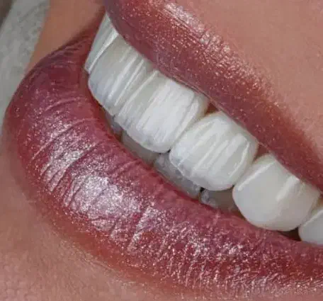 دندانپزشکی  تخصصی ترین مرکز ایمپلنت و جراحی|خدمات آرایشگری و زیبایی|ورزقان, |دیوار