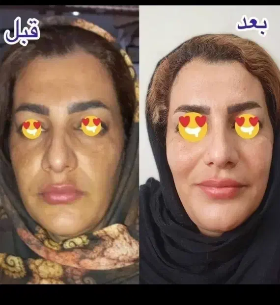 کرمات تصمینی|آرایشی، بهداشتی، درمانی|سوسنگرد, |دیوار