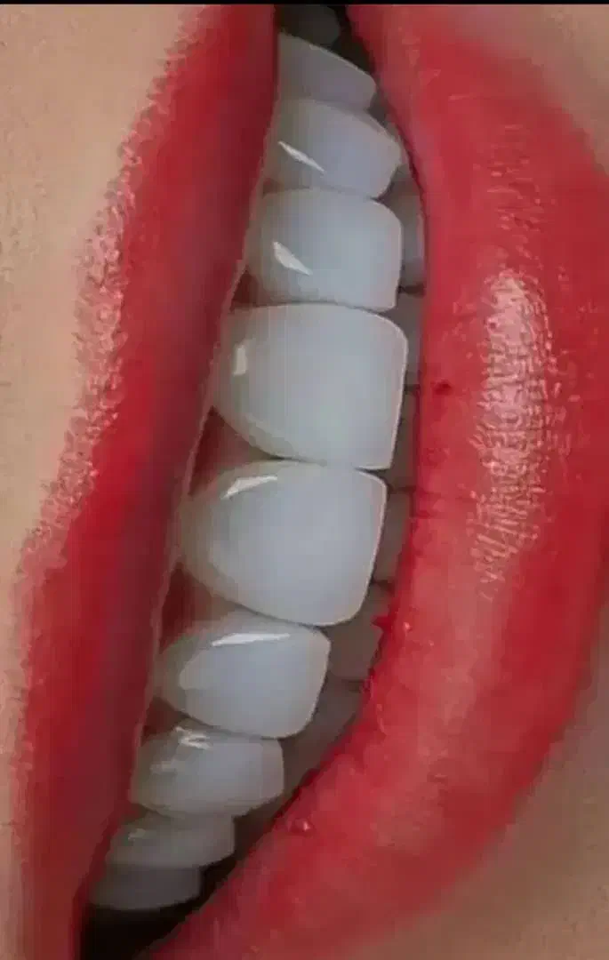 دندانپزشکی ، ایمپلنت، روکش، کامپوزیت ، عصب کشی|خدمات آرایشگری و زیبایی|کوهدشت, |دیوار