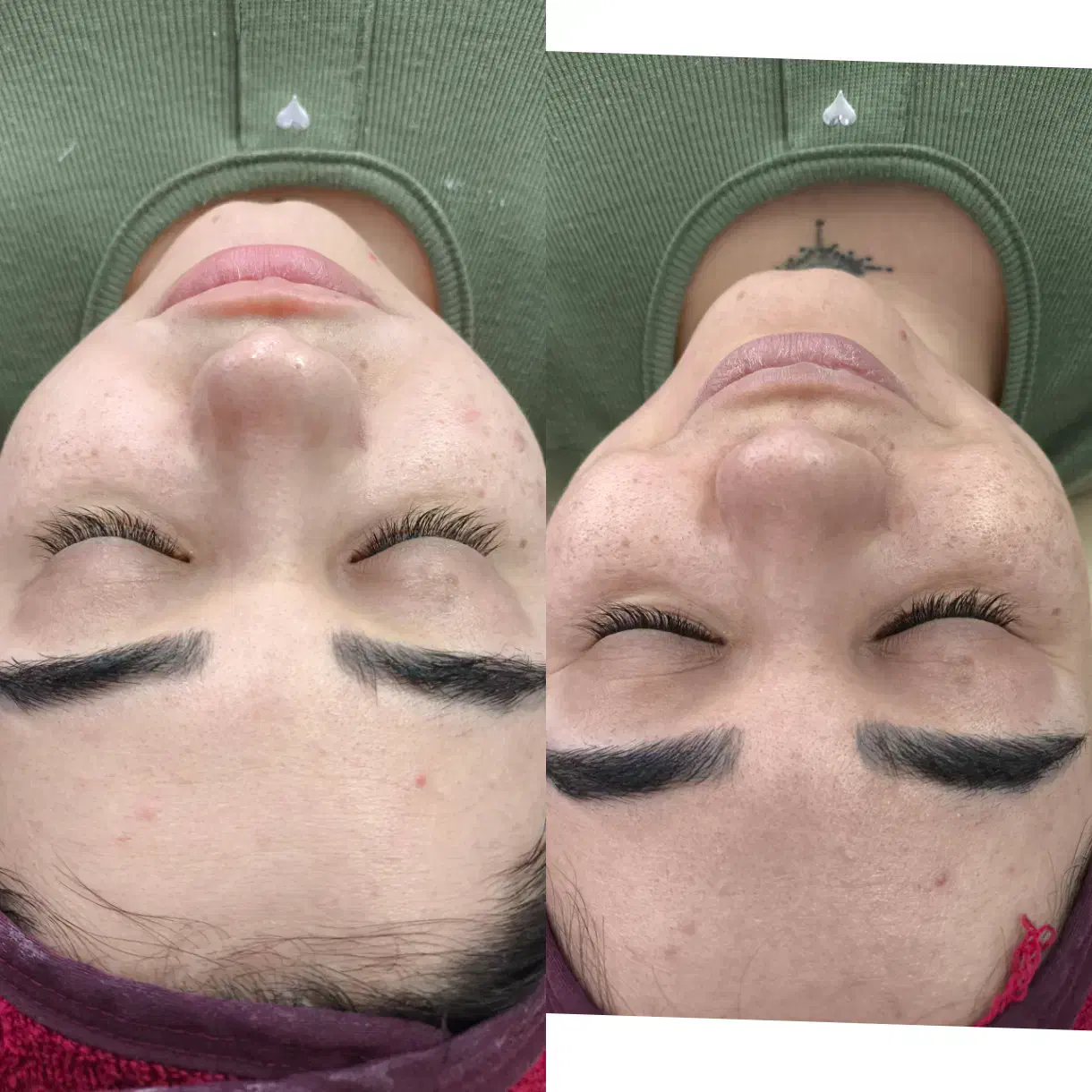 پاکسازی صورت|خدمات آرایشگری و زیبایی|زنجان, |دیوار