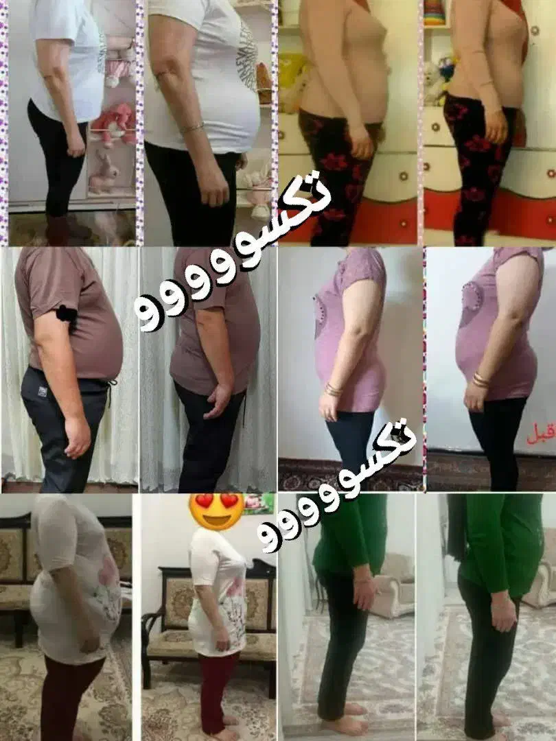 چربی سوزی مثل کره|آرایشی، بهداشتی، درمانی|زابل, |دیوار