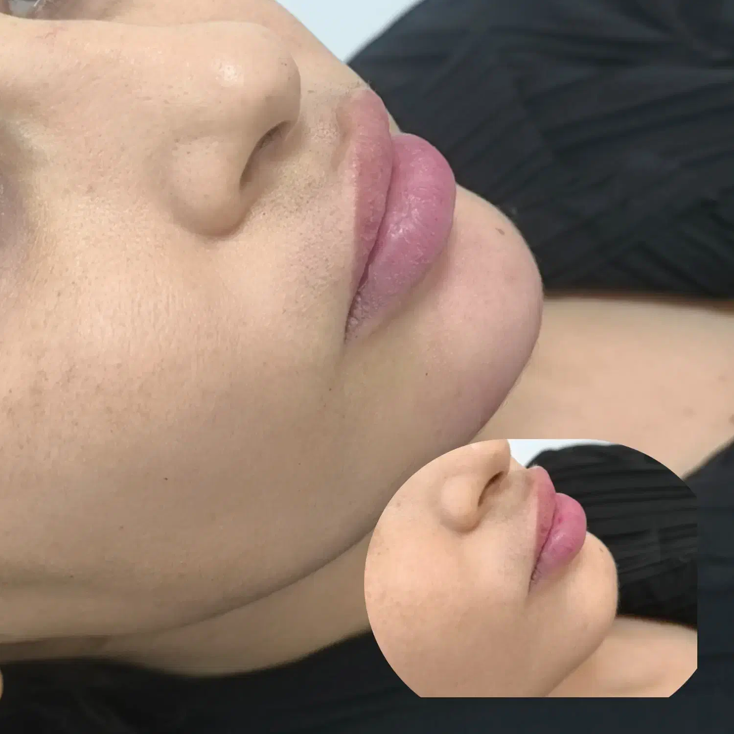 ژل وبوتاکس|خدمات آرایشگری و زیبایی|ایذه, |دیوار