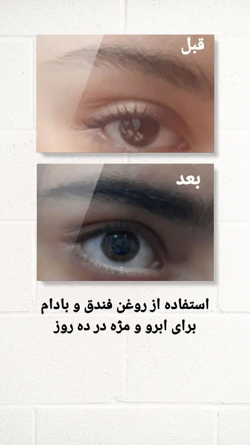 درمان اصلی ریزش مو|آرایشی، بهداشتی، درمانی|شوشتر, |دیوار