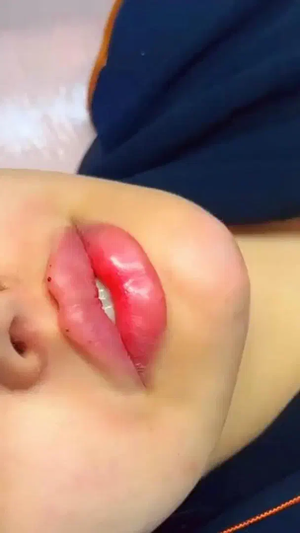آموزش ژل و بوتاکس|خدمات آموزشی|شیراز, زرهی|دیوار