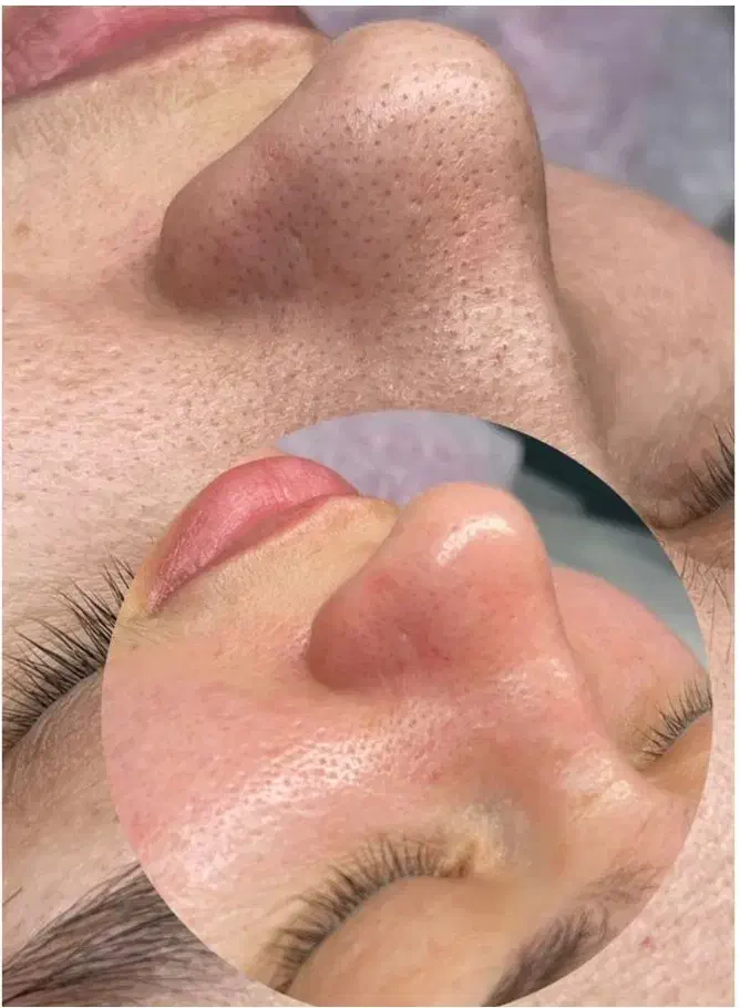 کلیه خدمات زیبایی و فیشال در کلینیک زیبایی میراکل|خدمات آرایشگری و زیبایی|لاهیجان, قیام|دیوار