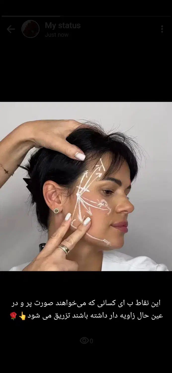 پی آرپی و مزوتراپی و سلول بنیادی|خدمات آرایشگری و زیبایی|خوی, |دیوار