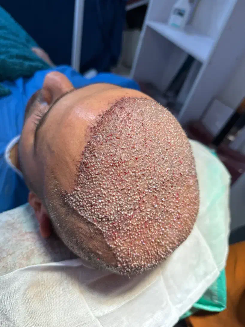 تخفیف ویژه کاشتمو|خدمات آرایشگری و زیبایی|فسا, |دیوار