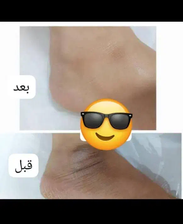 کرم بدن نقره|آرایشی، بهداشتی، درمانی|خاش, |دیوار