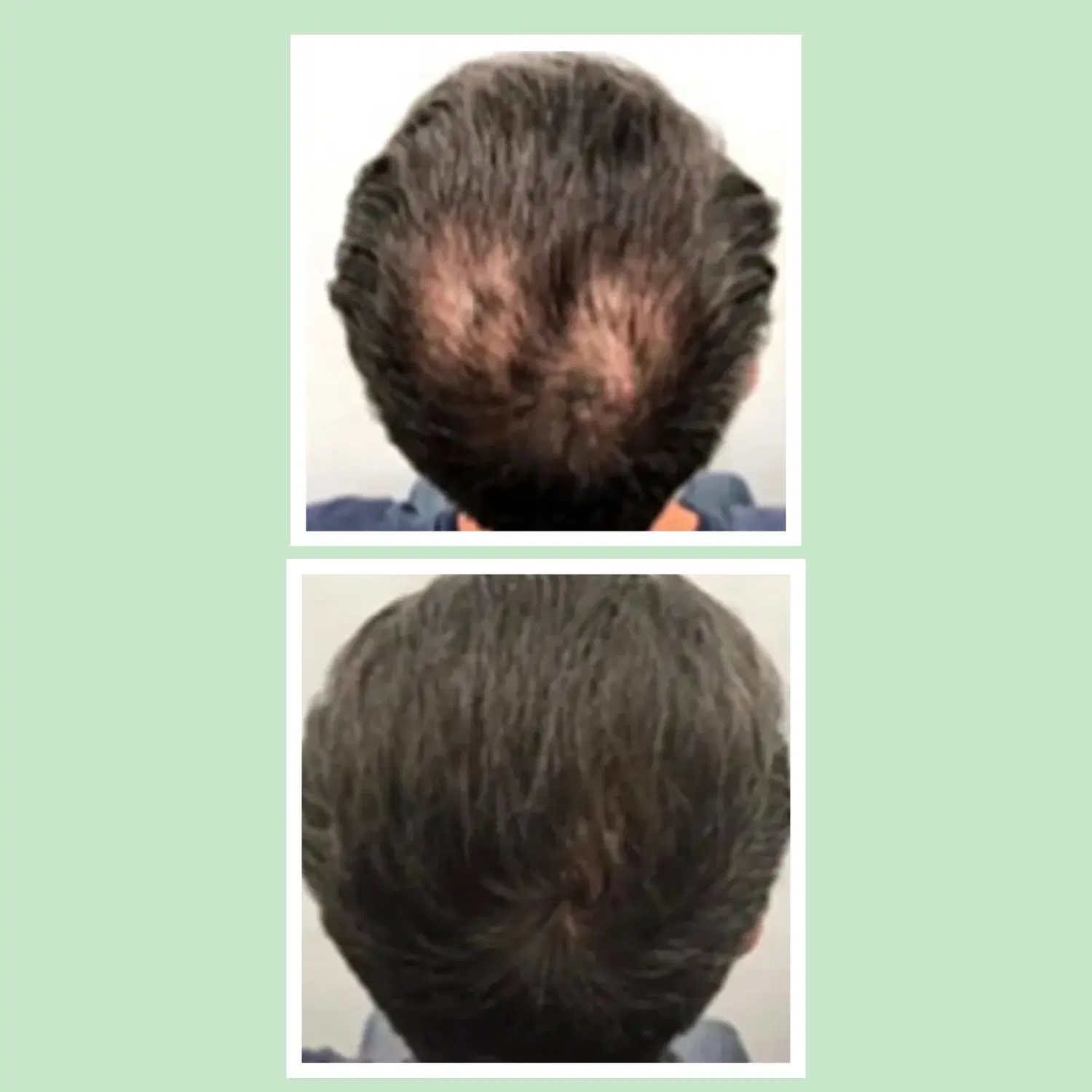 پک ویژه وارداتی (فقط تعداد محدود)|آرایشی، بهداشتی، درمانی|تهران, یوسفآباد|دیوار