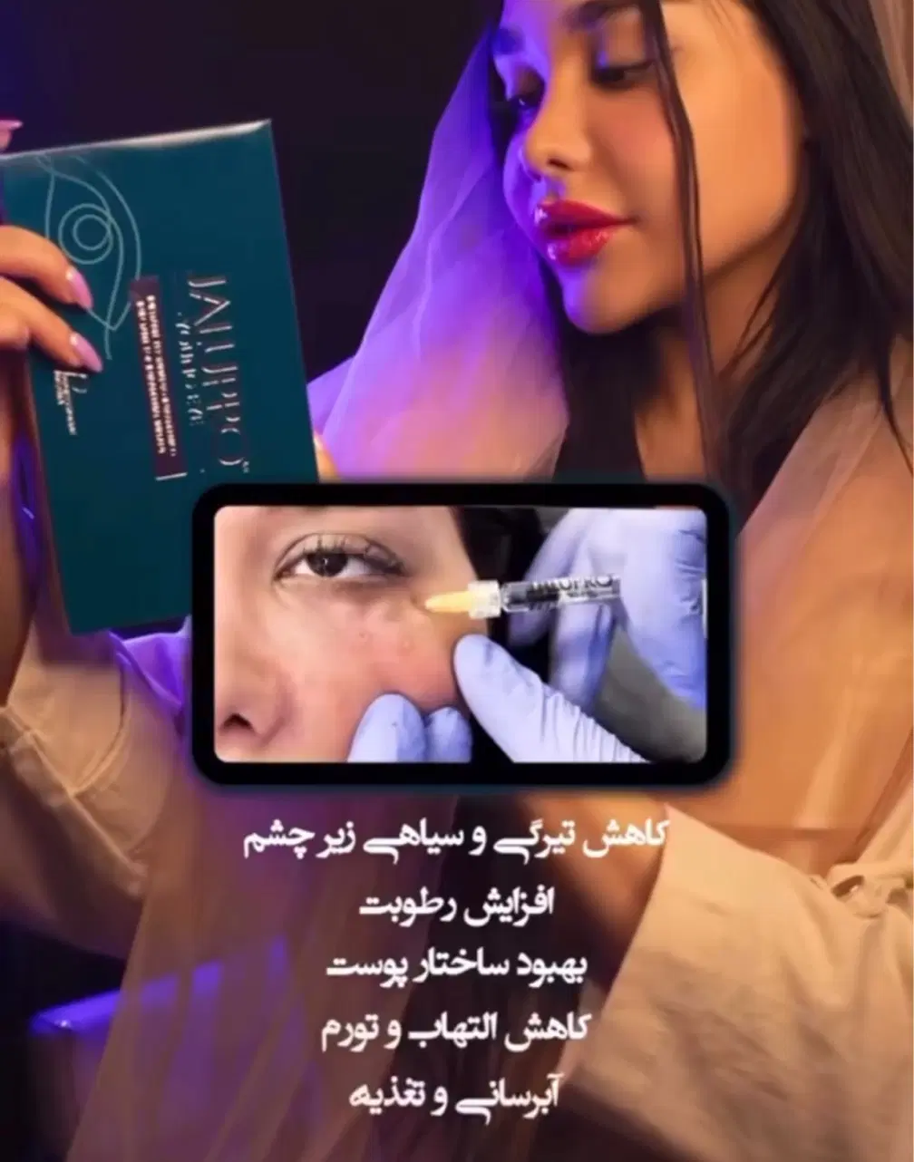 تزریق ژل و بوتاکس بهاره|خدمات زیبایی و سلامت|تهران, نعمتآباد|دیوار