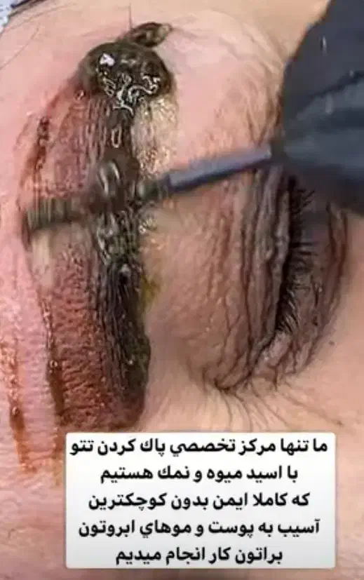 تخفیفات یلدایی ریموو تاتو /آرایش دائم|خدمات آرایشگری و زیبایی|سمنان, |دیوار