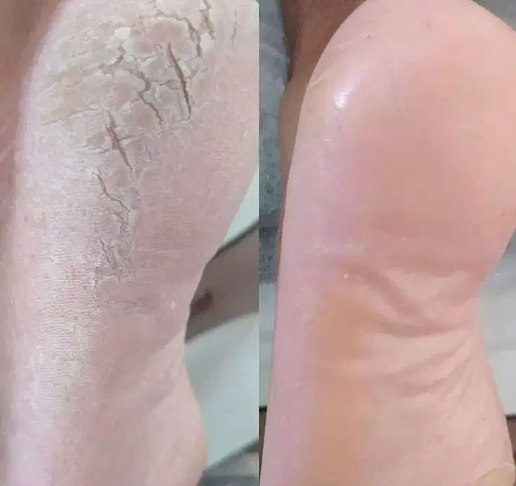 آف50درصدی آموزش و خدمات پدیکوردرمانی تا آخر ماه280|خدمات آرایشگری و زیبایی|آبادان, |دیوار