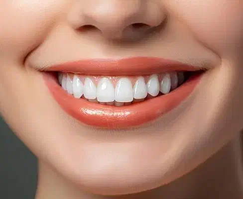 جشنواره دندانپزشکی دیجیتال با تخفیفات ویژه|خدمات آرایشگری و زیبایی|کرج, اصفهانی‌ها|دیوار