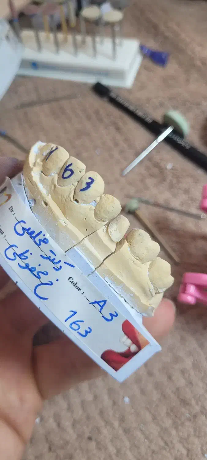 تکنسین قالبریز و کارآموز دستیاری دندانپزشکی|استخدام درمانی، زیبایی، بهداشتی|ری, فیروزآبادی|دیوار