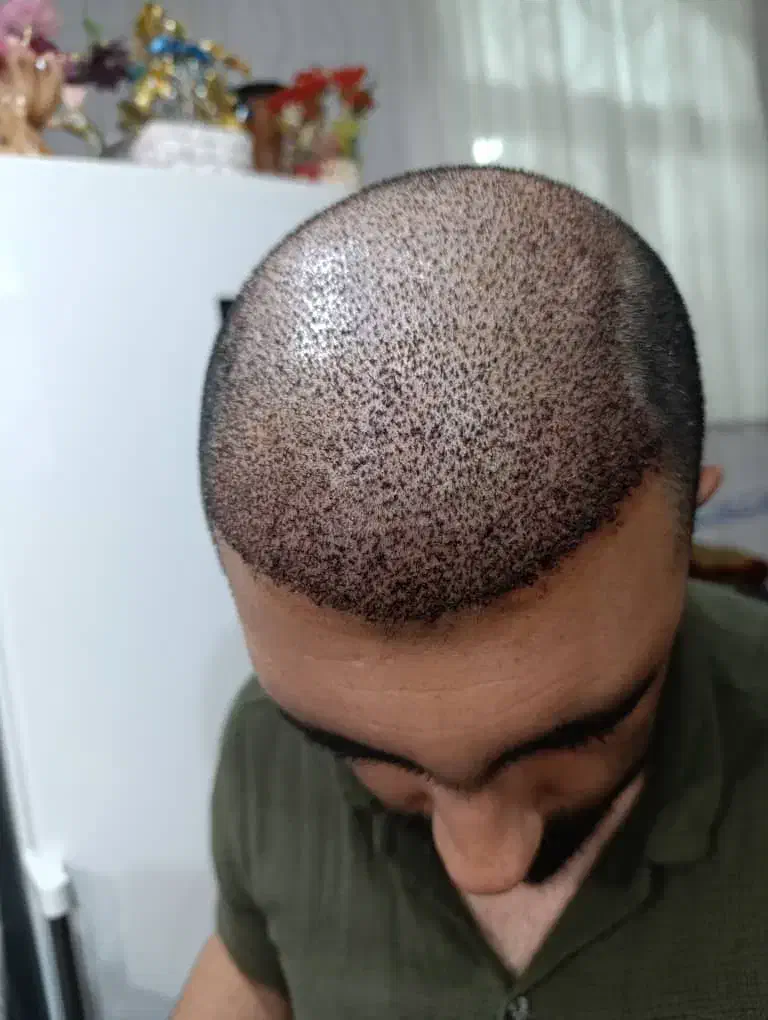 تخفیف ویژه کاشتمو|خدمات آرایشگری و زیبایی|فسا, |دیوار