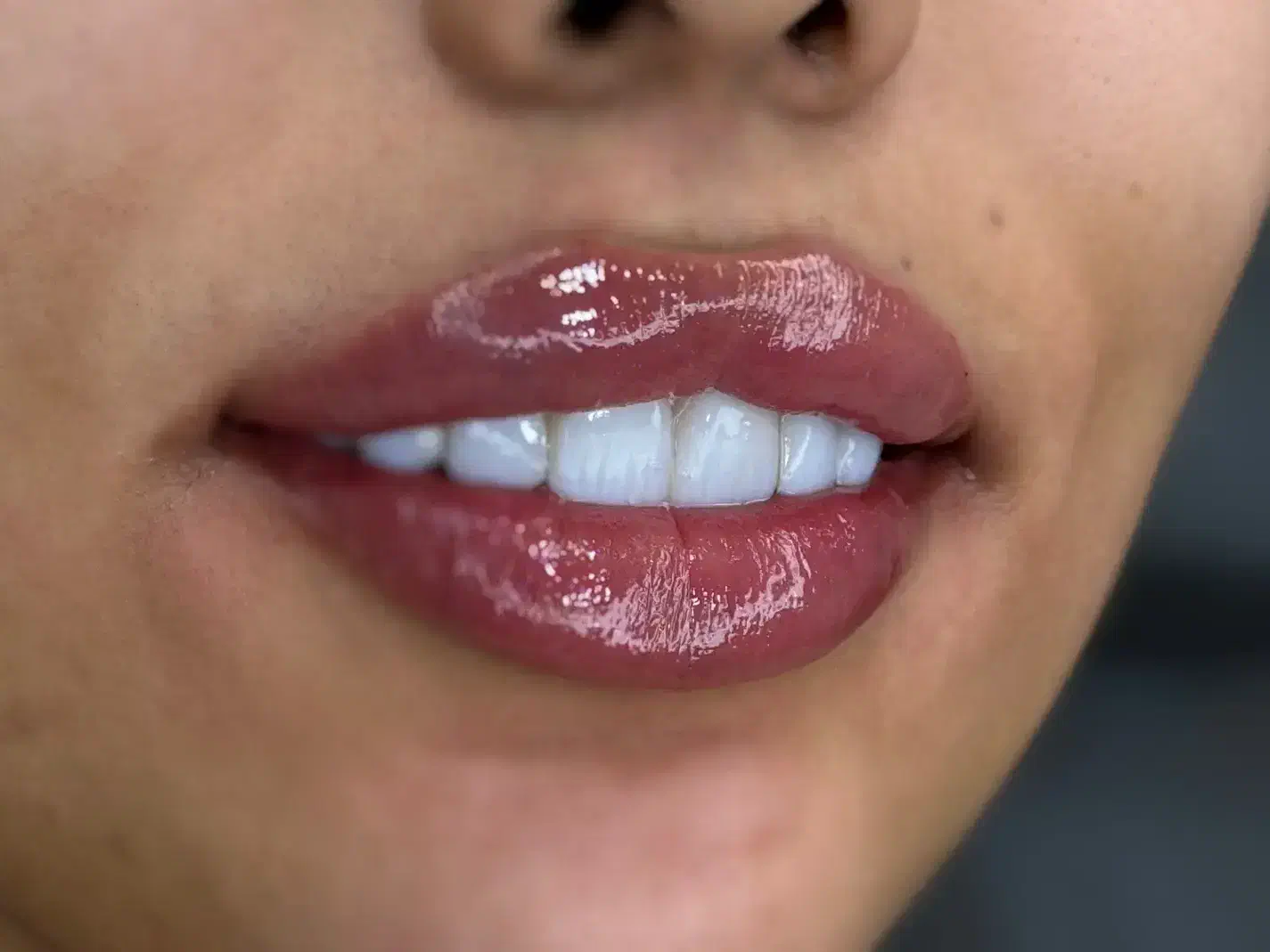 کارشناس تغذیه جهت لاین لاغری|استخدام درمانی، زیبایی، بهداشتی|اصفهان, جلفا|دیوار