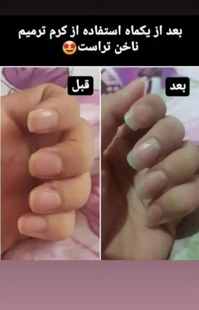 مشاوره درمانی|خدمات آرایشگری و زیبایی|شیراز, حافظیه|دیوار