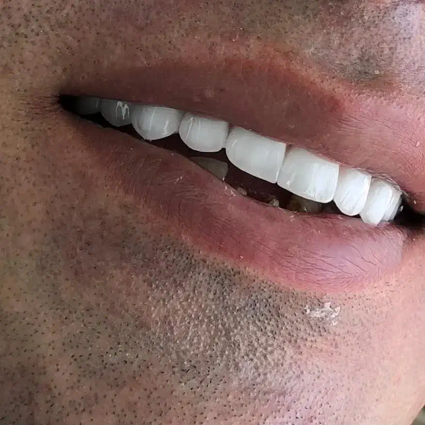 دندان سازی|خدمات آرایشگری و زیبایی|خوی, |دیوار