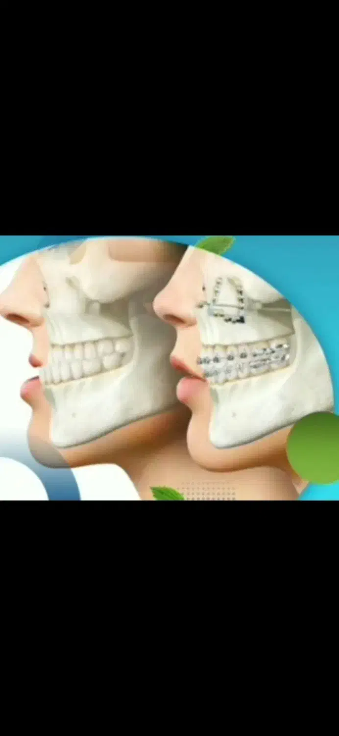 تجربه گرفتن برای عمل فک|فعالیت داوطلبانه تحقیقاتی|مشهد, ابوذر|دیوار