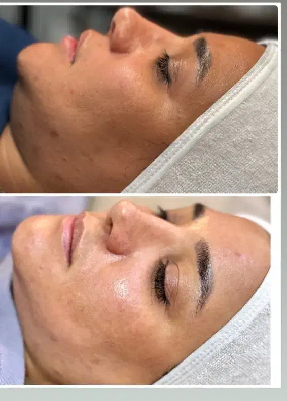 فشیال vip تخفیف|خدمات آرایشگری و زیبایی|مشهد, ایثار|دیوار