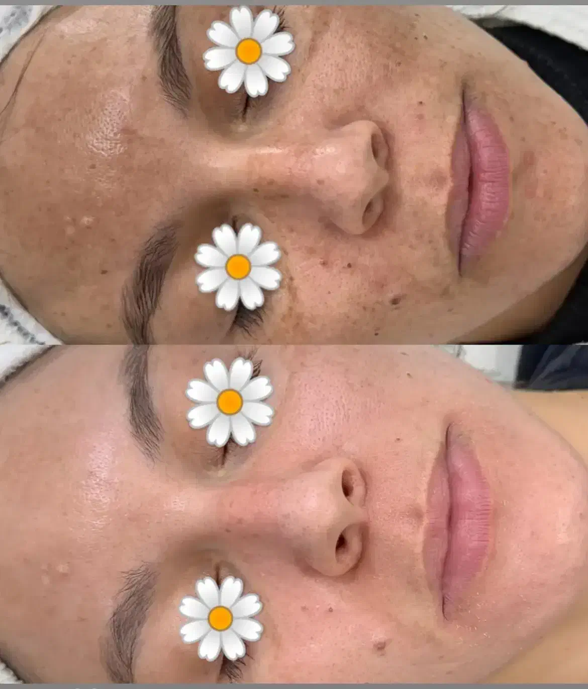 خروج لک و کک مک جای جوش با درمان تلفیقی|خدمات آرایشگری و زیبایی|سبزوار, کاشفی شمالی (دادگستری)|دیوار