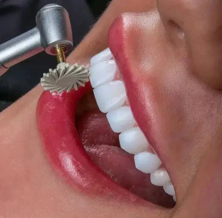 کامپوزیت دندان بابهترین موادفقط وفقط واحدی۹۹۹|خدمات آرایشگری و زیبایی|نیشابور, دارایی|دیوار