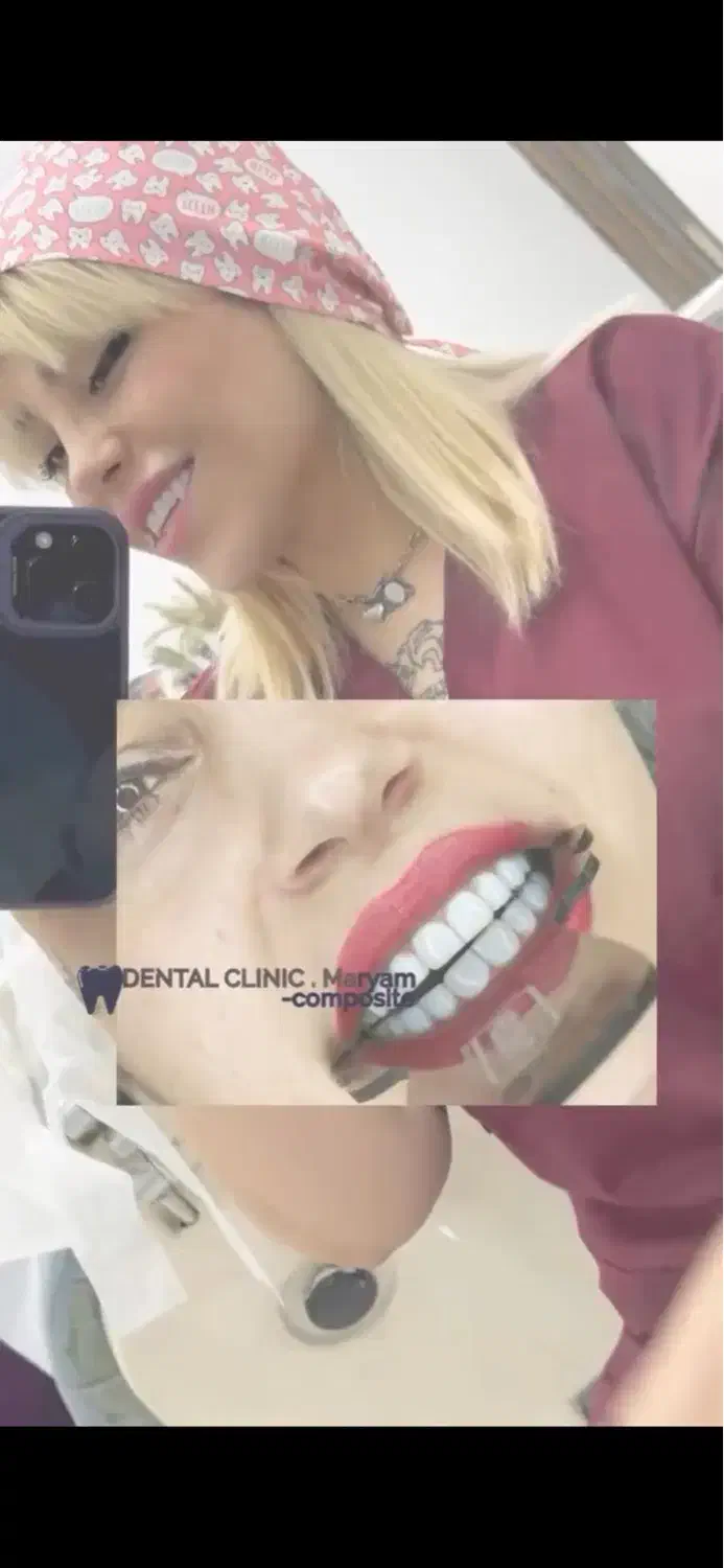 کامپوزیت دندان تعرفه دولتی|خدمات آرایشگری و زیبایی|کارون, |دیوار