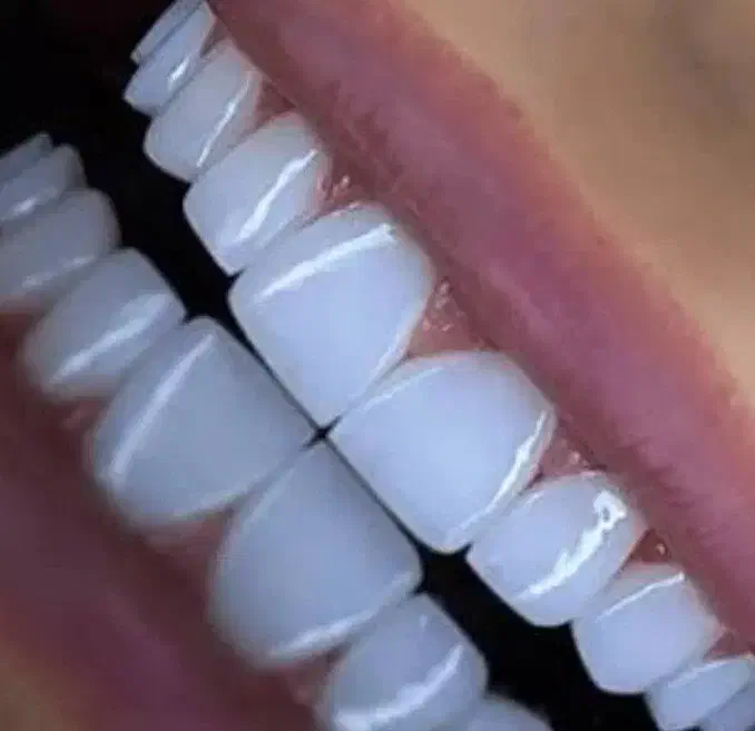 دندانپزشکی|خدمات آرایشگری و زیبایی|دیواندره, |دیوار