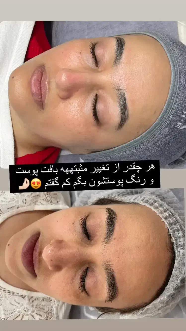 پاکسازی پوست فیشال پوست فیشیال پوست|خدمات آرایشگری و زیبایی|تهران, مجیدیه|دیوار