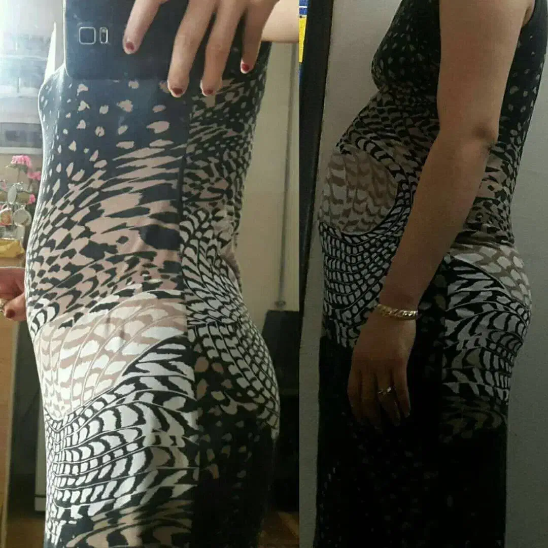 کاهش وزن اصولی|آرایشی، بهداشتی، درمانی|یزد, |دیوار