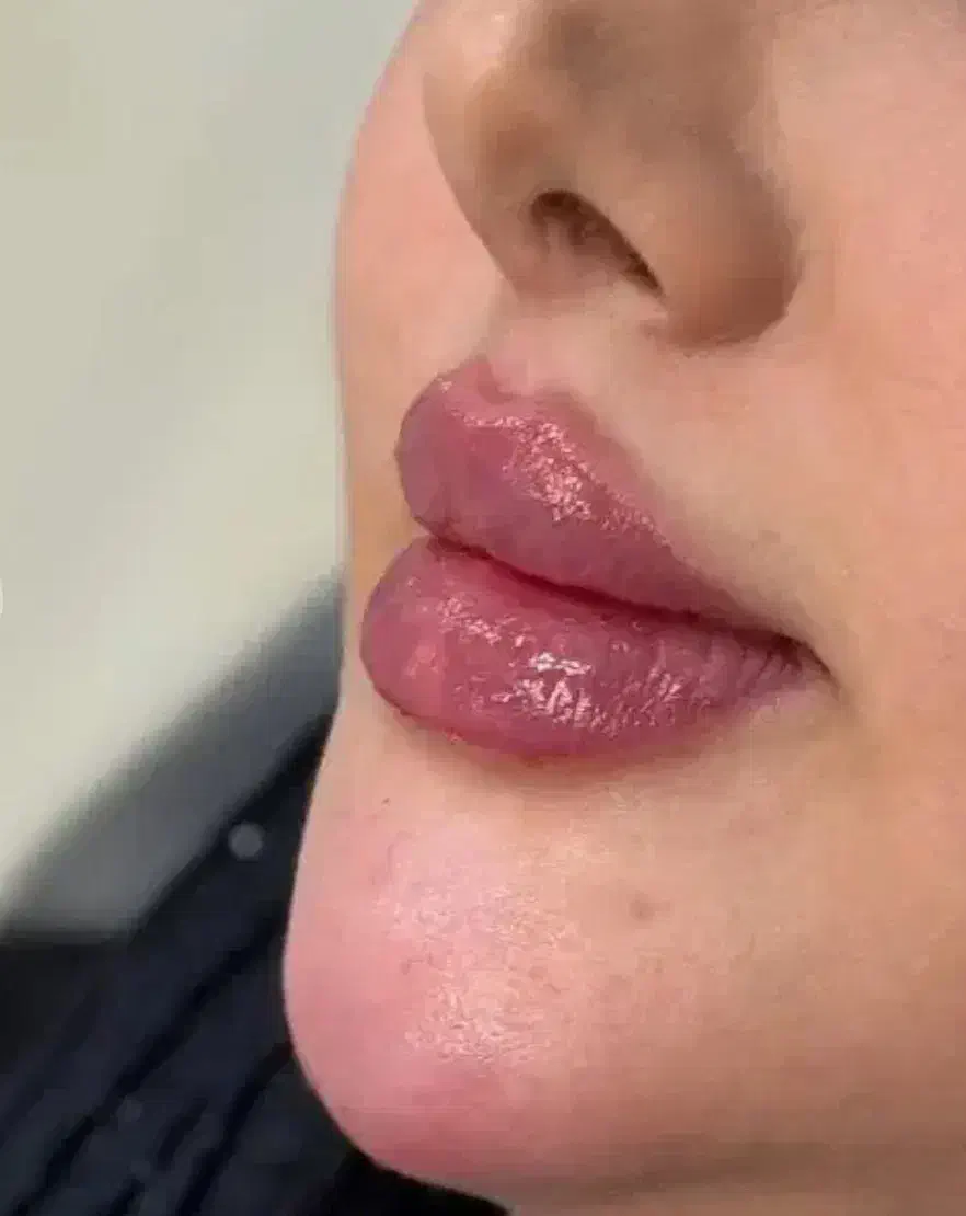 ژل لب|خدمات آرایشگری و زیبایی|اسلامشهر, شهرک مهدیه|دیوار