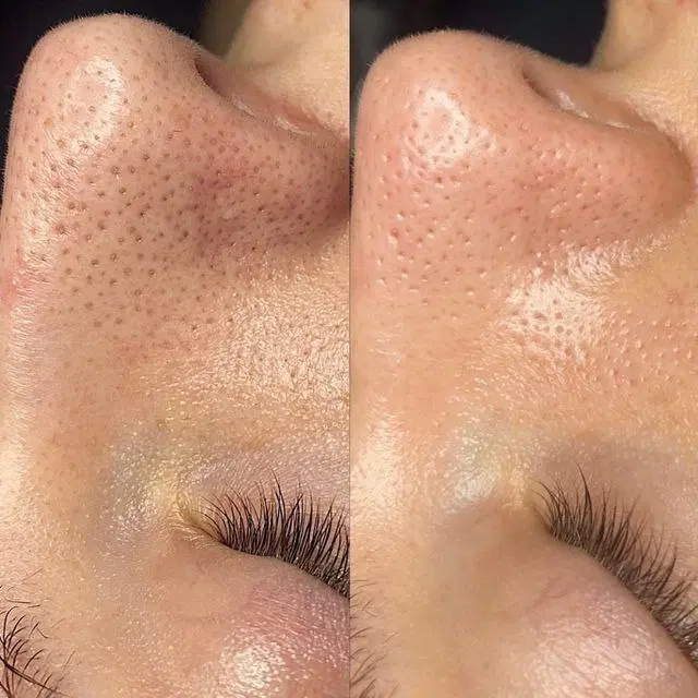 خدمات و اموزش فیشال اسکراب اسکالپ الگاپیل جوانسازی|خدمات زیبایی و سلامت|تهران, تهرانپارس غربی|دیوار