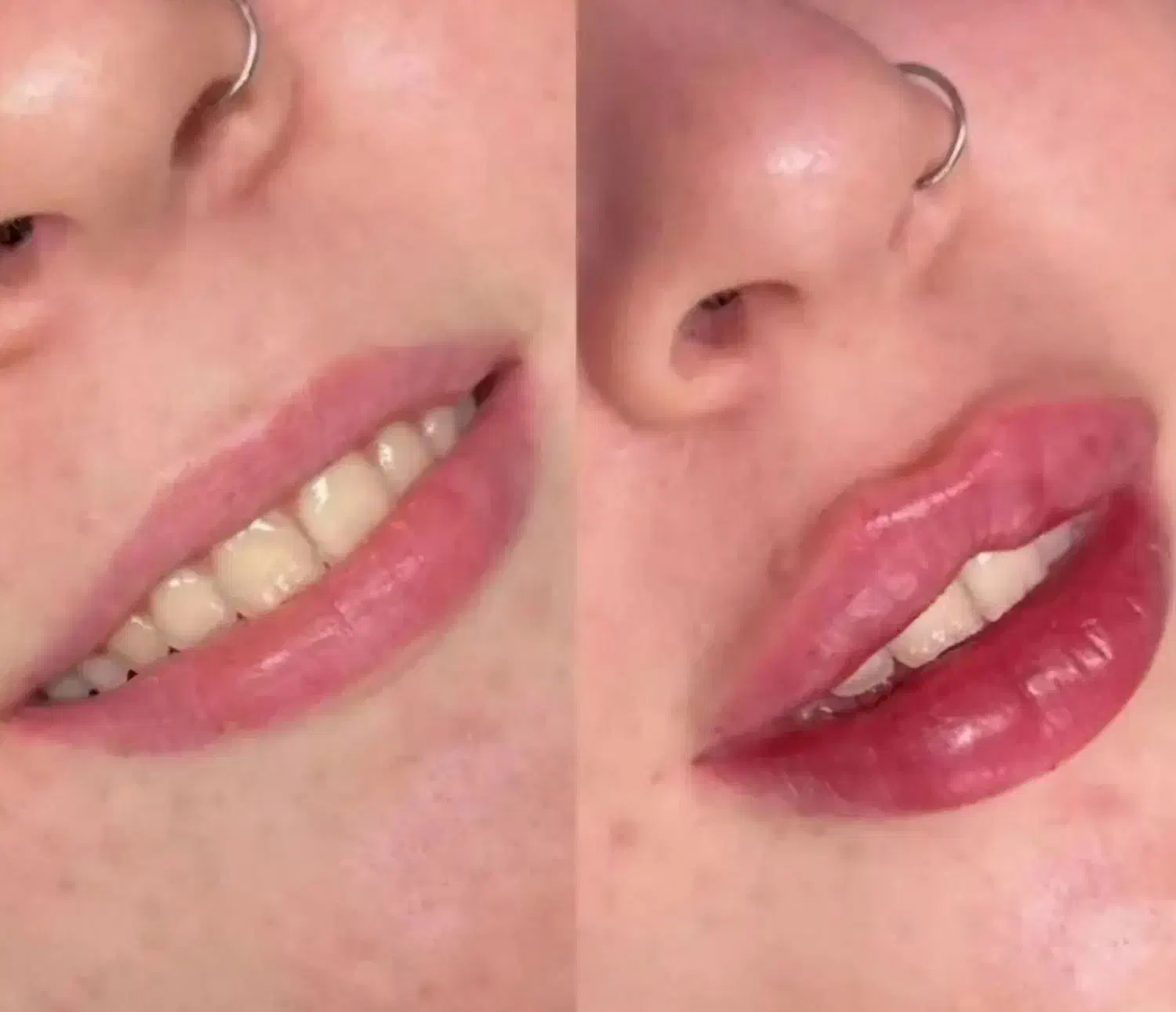 جشنواره پاییزه تزریق ژل بوتاکس مزوژل درکلینیک پزشک|خدمات آرایشگری و زیبایی|اصفهان, وحید|دیوار