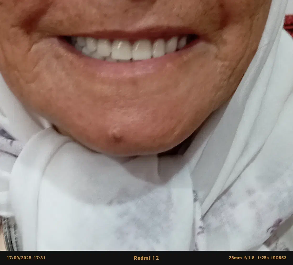 دندانسازی|آرایشی، بهداشتی، درمانی|جغتای, |دیوار