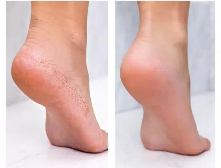 تخفیف ۳۰ درصدی پدیکور و مانیکور و پارافین تراپی|خدمات آرایشگری و زیبایی|کاشان, کشاورز|دیوار