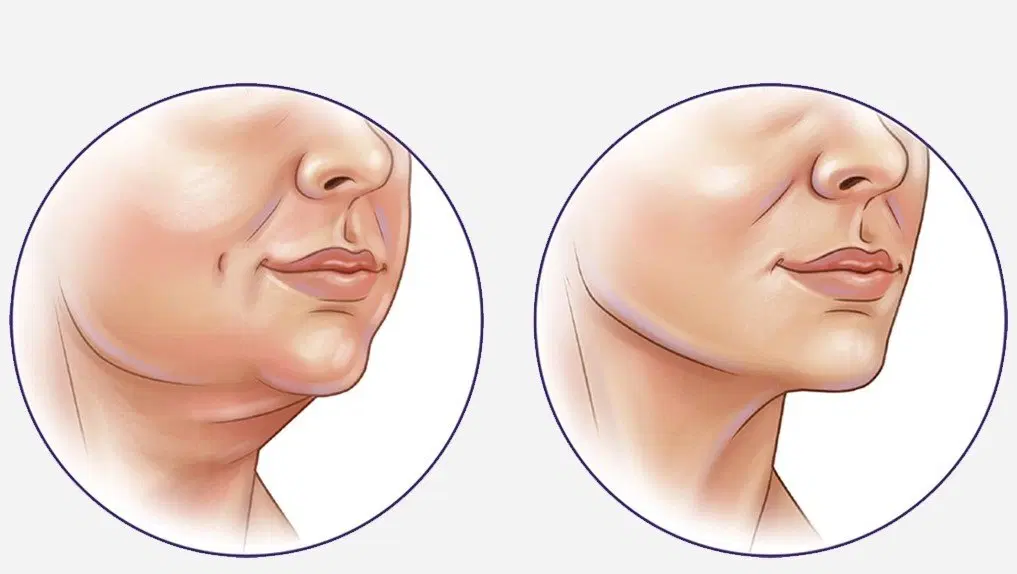 منشی خانم در مطب زیبایی|استخدام درمانی، زیبایی، بهداشتی|تهران, آرژانتین|دیوار