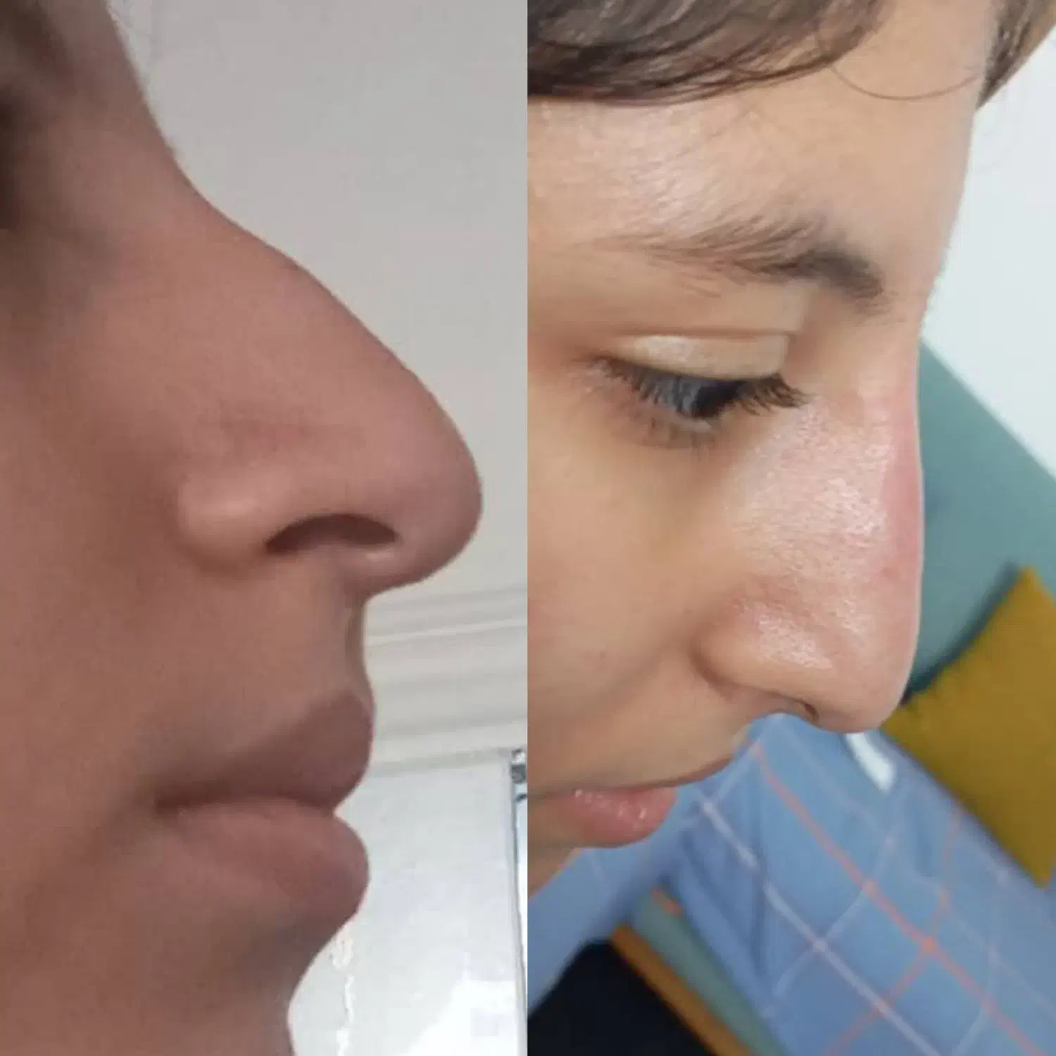 اموزش و خدمات بوتاکس و فیلروفیشیال و فیلر بادی|خدمات آرایشگری و زیبایی|شیراز, کوشک میدان|دیوار