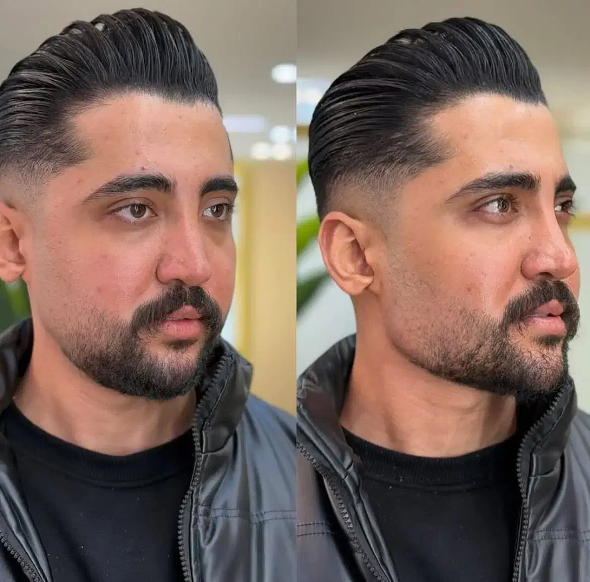 تزریق فیلر بوتاکس،نخ لیفتینگ بانصف قیمت بازار|خدمات آرایشگری و زیبایی|کرمانشاه, |دیوار