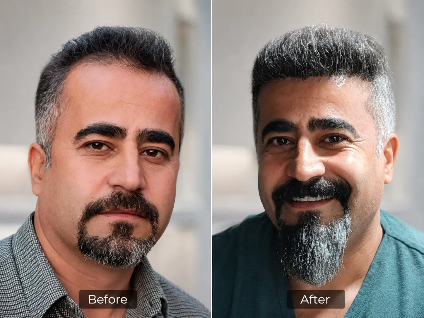 کاشت مو توسط تکنسین های شیراز با تخفیف ویژه|خدمات زیبایی و سلامت|کرمانشاه, |دیوار